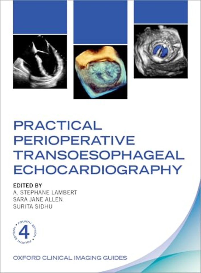 Practical Perioperative Transoesophageal Echocardiography