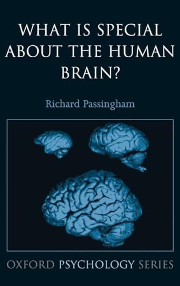 What is special about the human brain?