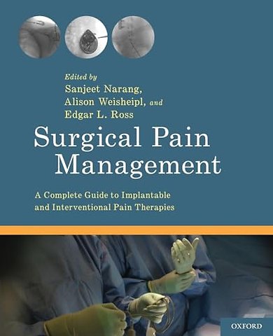 Surgical Pain Management