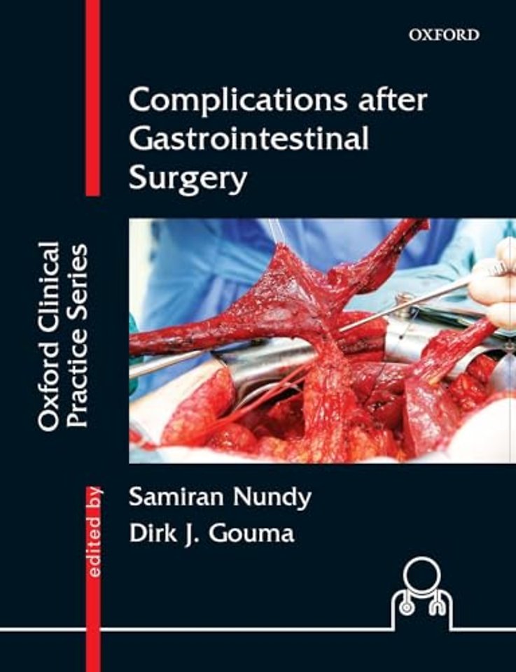 Complications after Gastrointestinal Surgery