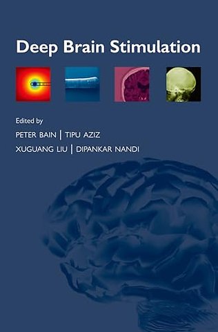 Deep Brain Stimulation