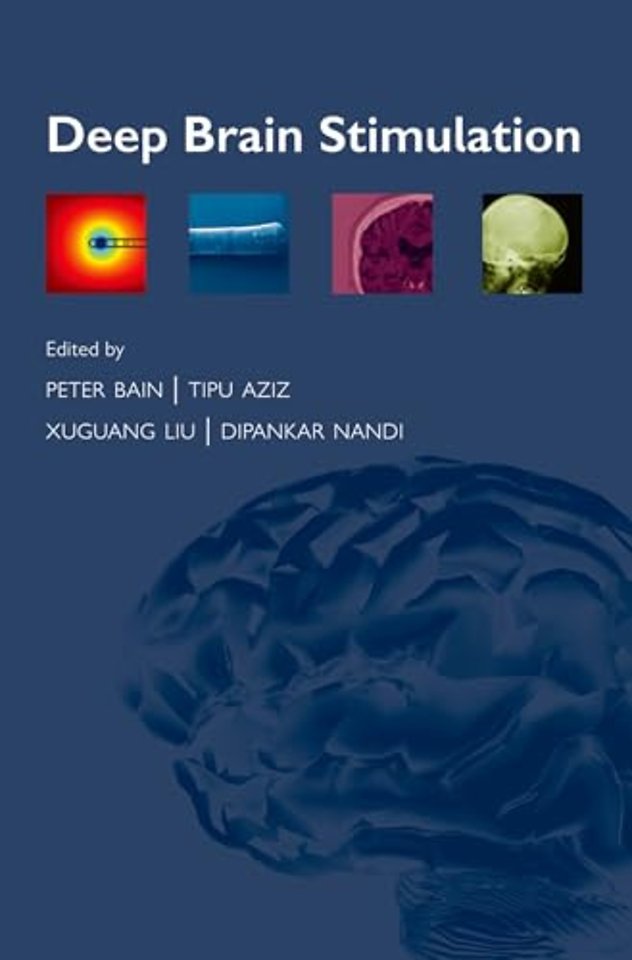 Deep Brain Stimulation