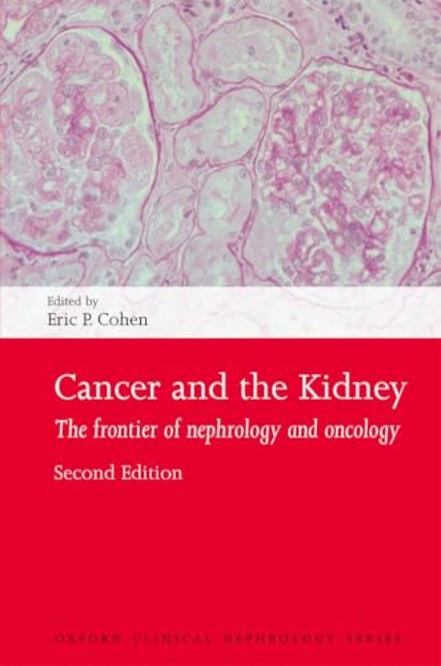 Cancer and the Kidney