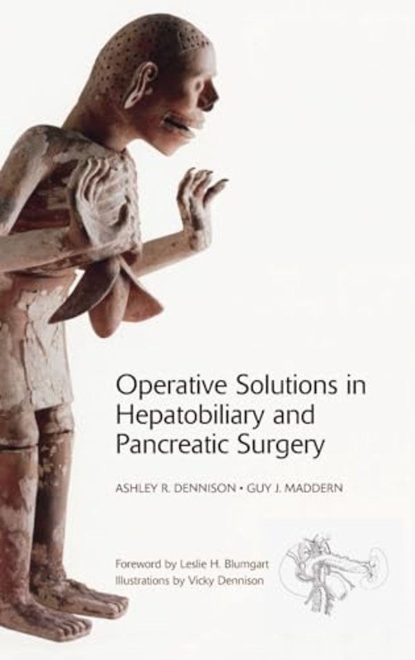 Operative Solutions in Hepatobiliary and Pancreatic Surgery