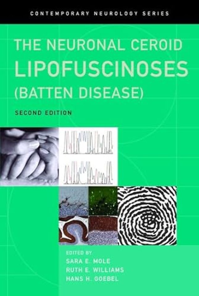 The Neuronal Ceroid Lipofuscinoses (Batten Disease)