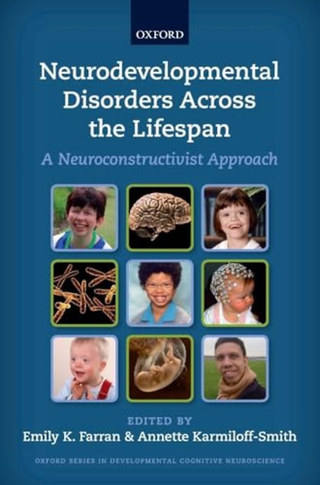 Neurodevelopmental Disorders Across the Lifespan