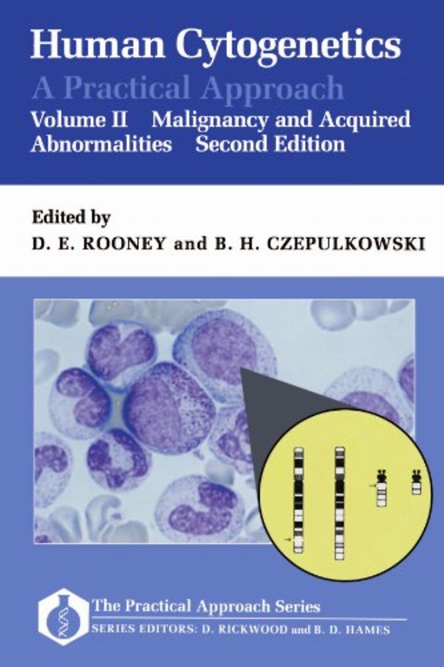 Human Cytogenetics: A Practical Approach: Volume II: Malignancy and Acquired Abnormalities
