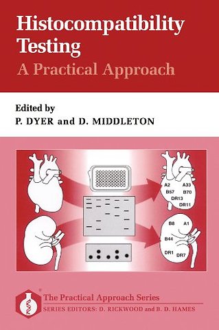 Histocompatibility Testing: A Practical Approach