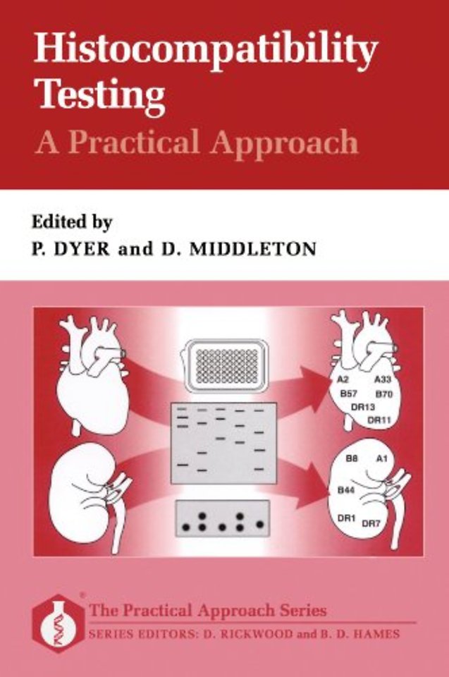 Histocompatibility Testing: A Practical Approach