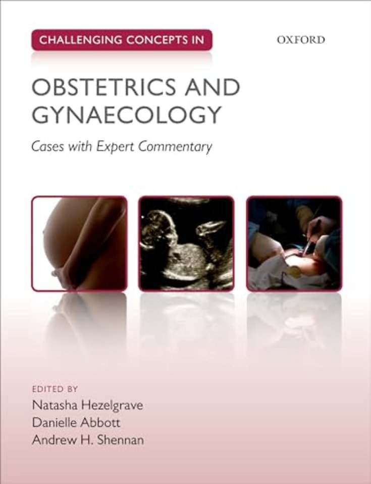 Challenging Concepts in Obstetrics and Gynaecology