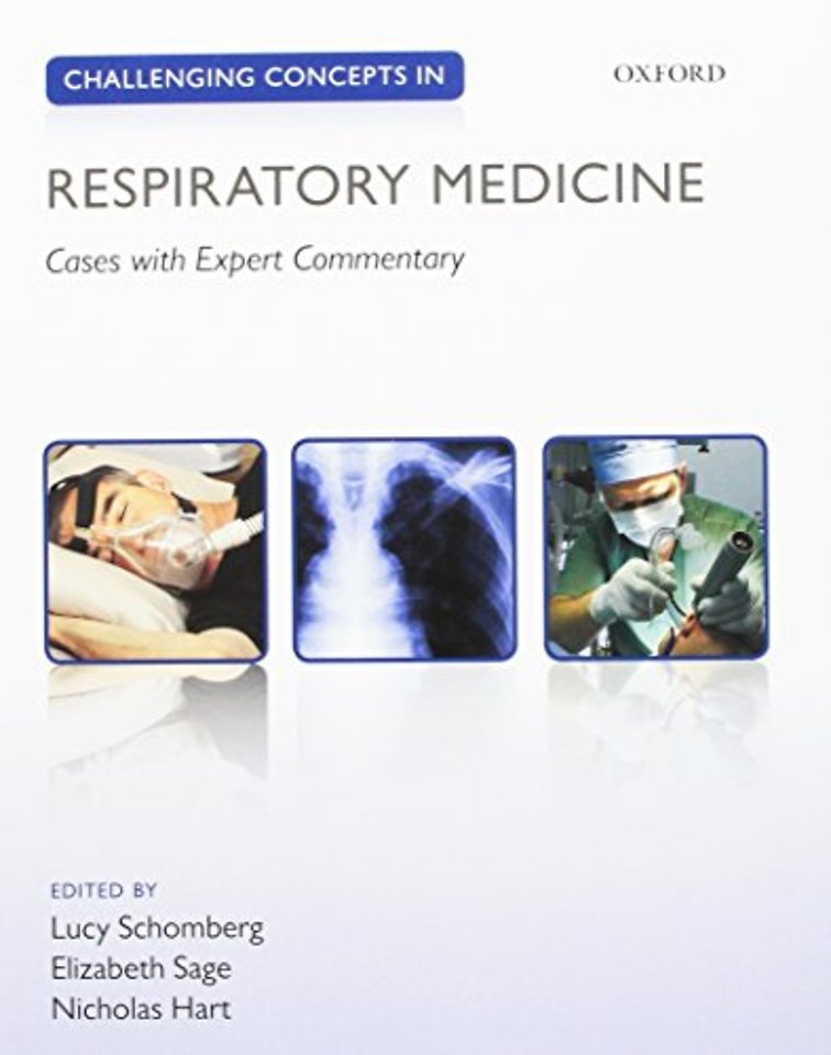 Challenging Concepts in Respiratory Medicine