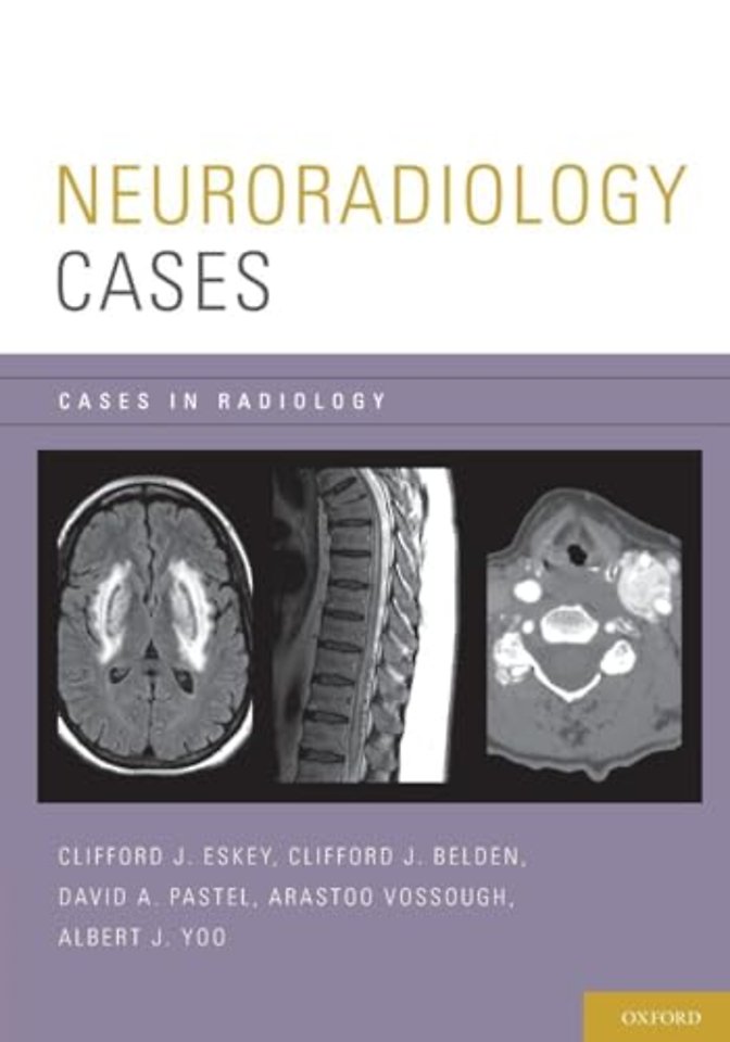 Neuroradiology Cases