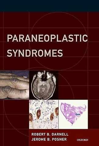 Paraneoplastic Syndromes