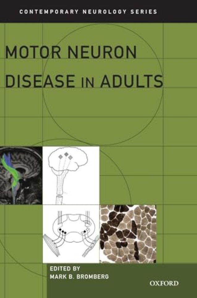 Motor Neuron Disease in Adults