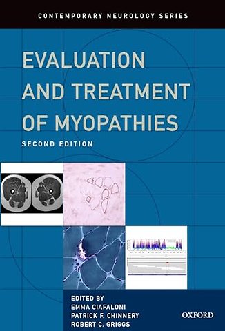Evaluation and Treatment of Myopathies