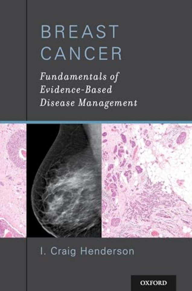 Breast Cancer
