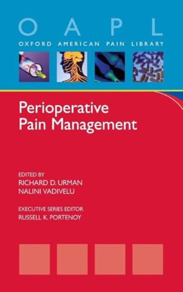 Perioperative Pain Management