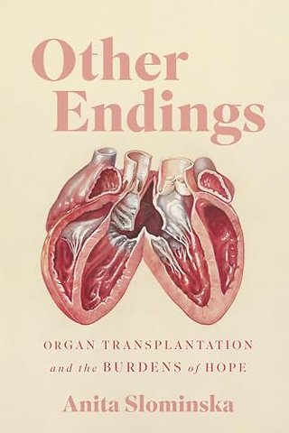 Other Endings – Organ Transplantation and the Burdens of Hope