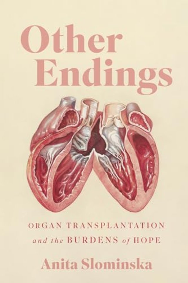 Other Endings – Organ Transplantation and the Burdens of Hope