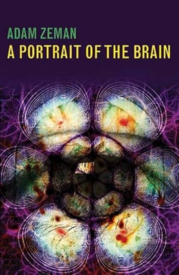 A Portrait of the Brain