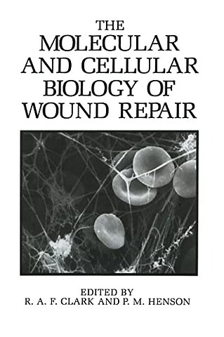 The Molecular and Cellular Biology of Wound Repair