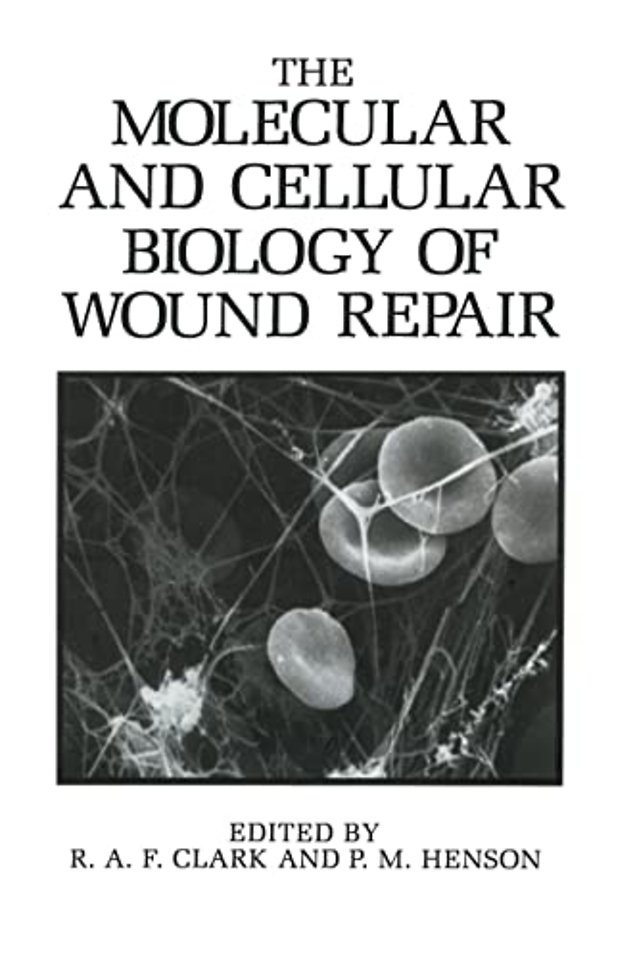 The Molecular and Cellular Biology of Wound Repair