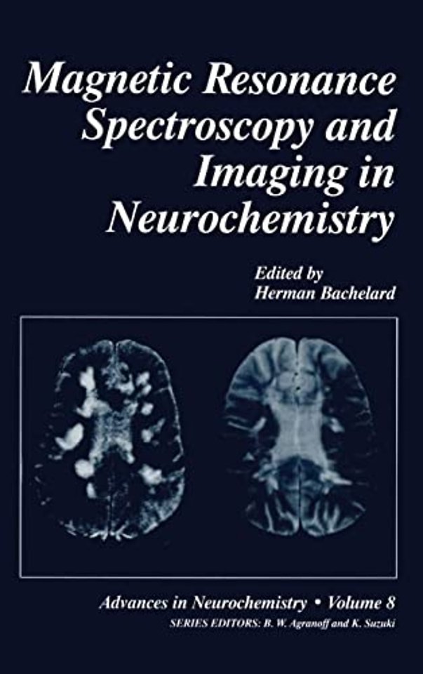 Magnetic Resonance Spectroscopy and Imaging in Neurochemistry