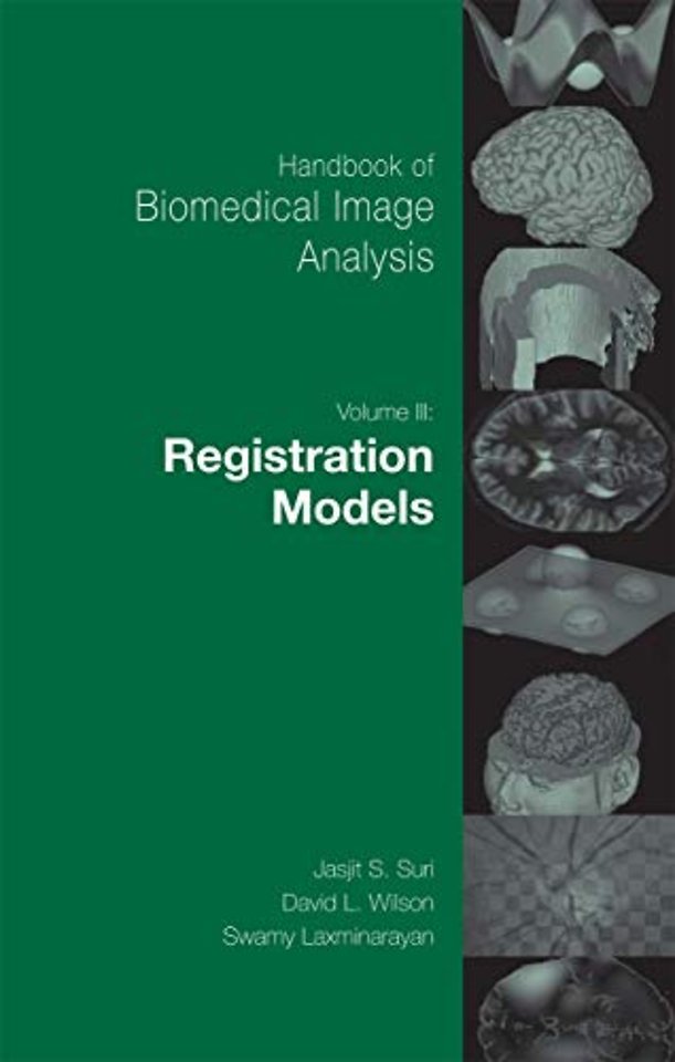 Handbook of Biomedical Image Analysis