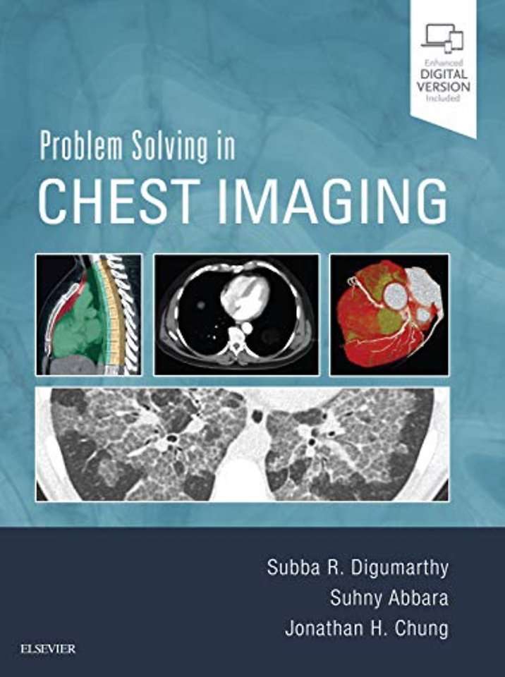 Problem Solving in Chest Imaging