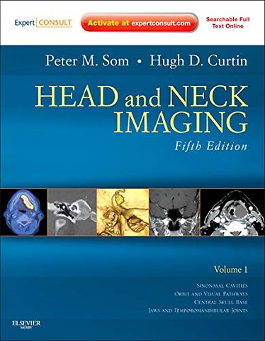Head and Neck Imaging - 2 Volume Set