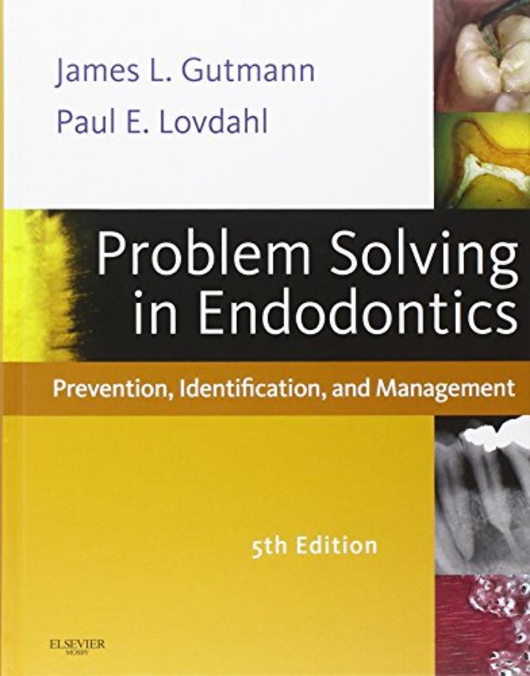 Problem Solving in Endodontics