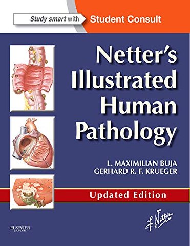 Netter's Illustrated Human Pathology Updated Edition