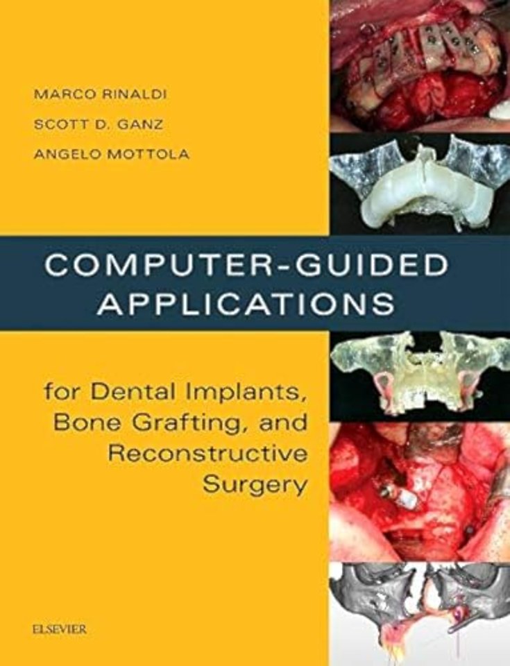 Computer-Guided Applications for Dental Implants, Bone Grafting, and Reconstructive Surgery (adapted translation)