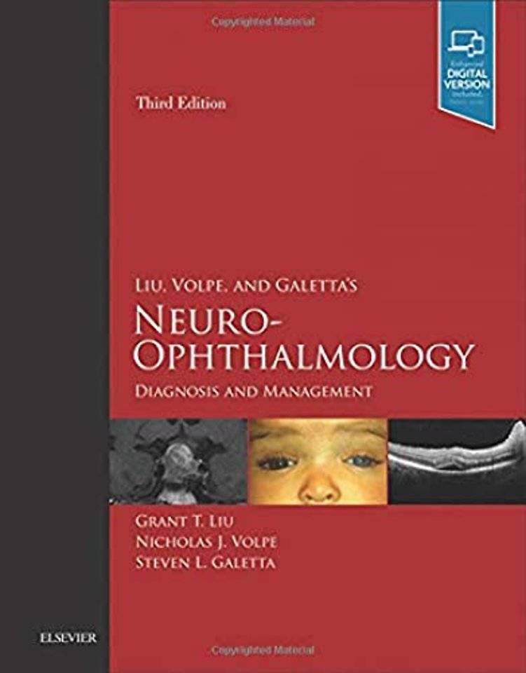 Liu, Volpe, and Galetta’s Neuro-Ophthalmology