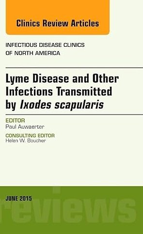 Lyme Disease and Other Infections Transmitted by Ixodes scapularis, An Issue of Infectious Disease Clinics of North America