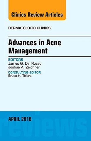 Advances in Acne Management, An Issue of Dermatologic Clinics