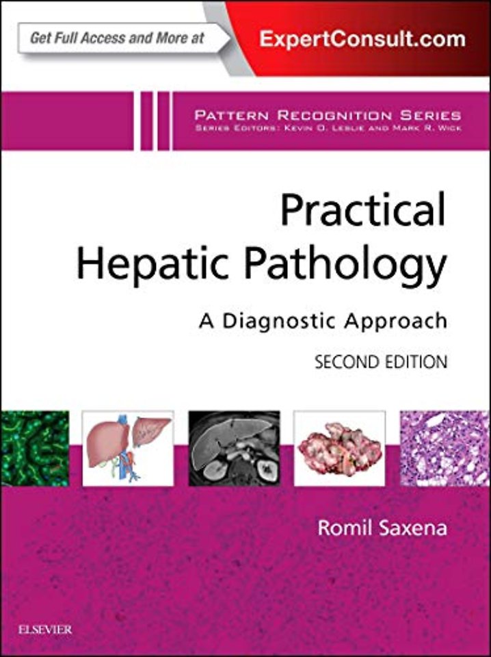 Practical Hepatic Pathology: A Diagnostic Approach