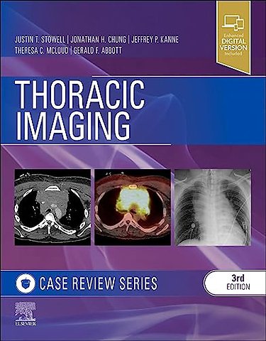 Thoracic Imaging: Case Review