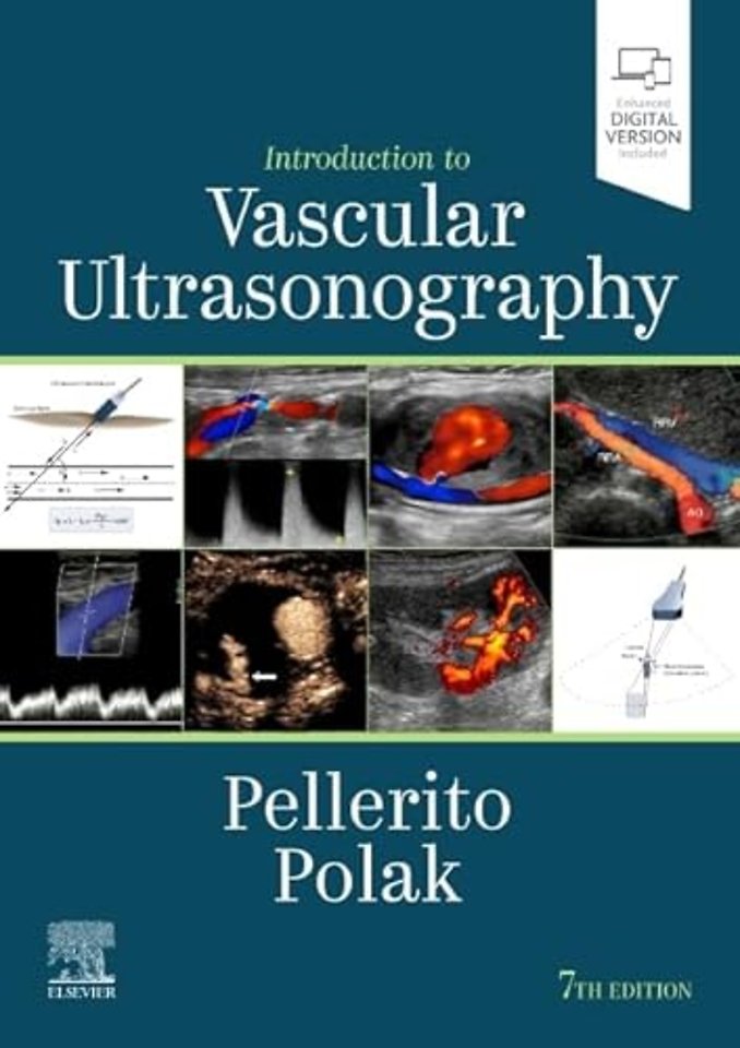 Introduction to Vascular Ultrasonography