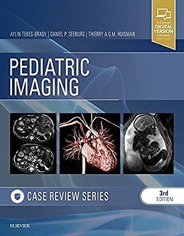 Pediatric Imaging: Case Review Series
