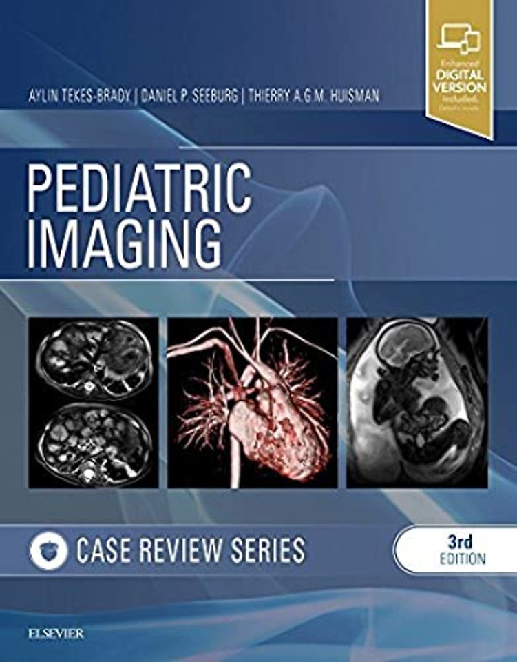 Pediatric Imaging: Case Review Series