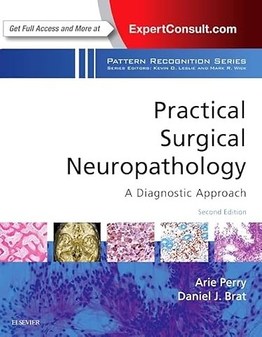 Practical Surgical Neuropathology: A Diagnostic Approach