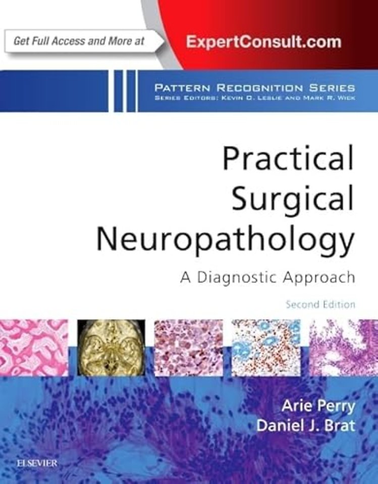 Practical Surgical Neuropathology: A Diagnostic Approach