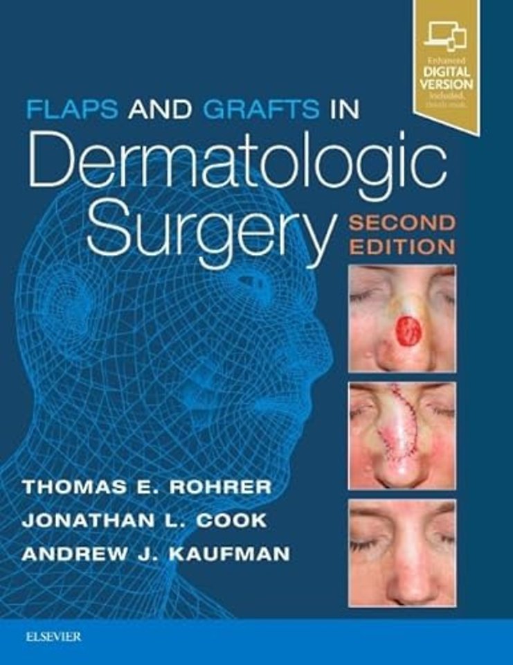 Flaps and Grafts in Dermatologic Surgery