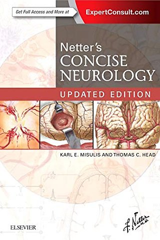 Netter's Concise Neurology Updated Edition
