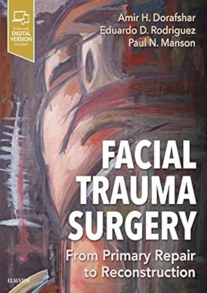 Facial Trauma Surgery