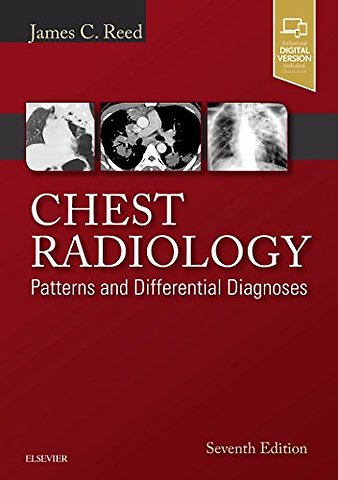 Chest Radiology