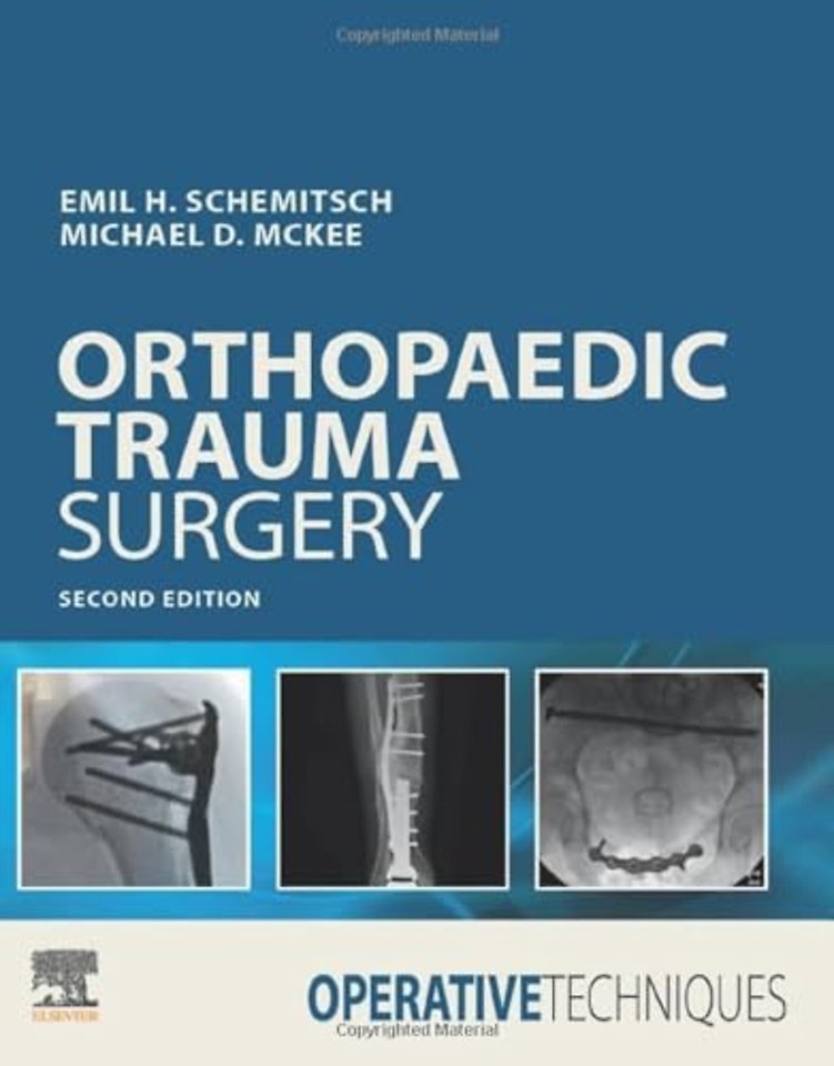 Operative Techniques: Orthopaedic Trauma Surgery