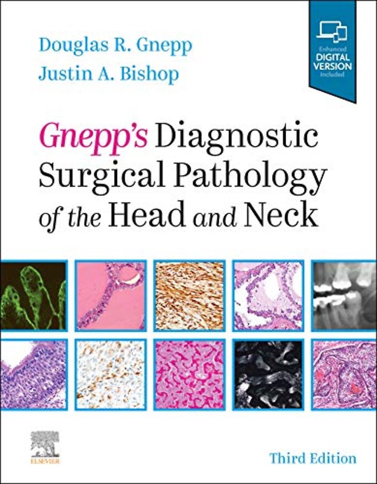 Gnepp's Diagnostic Surgical Pathology of the Head and Neck