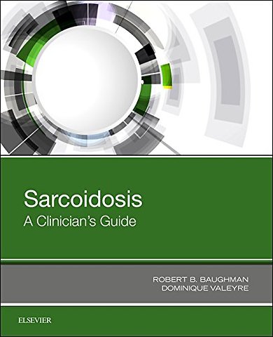 Sarcoidosis